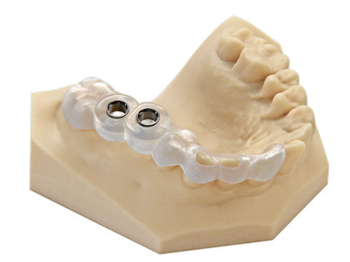 E-Model Light envisiontec