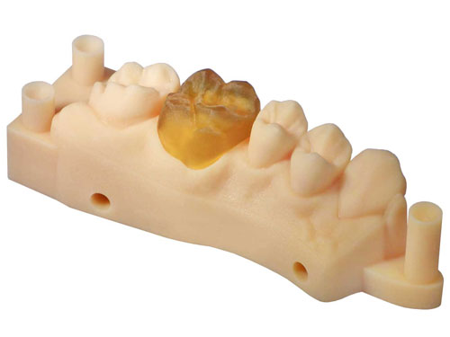 E-Partial crown envisiontec